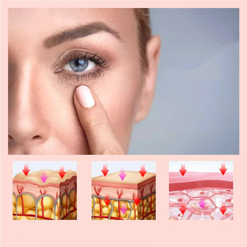 Micro-electric Instrument for Eye-Bags Treatment