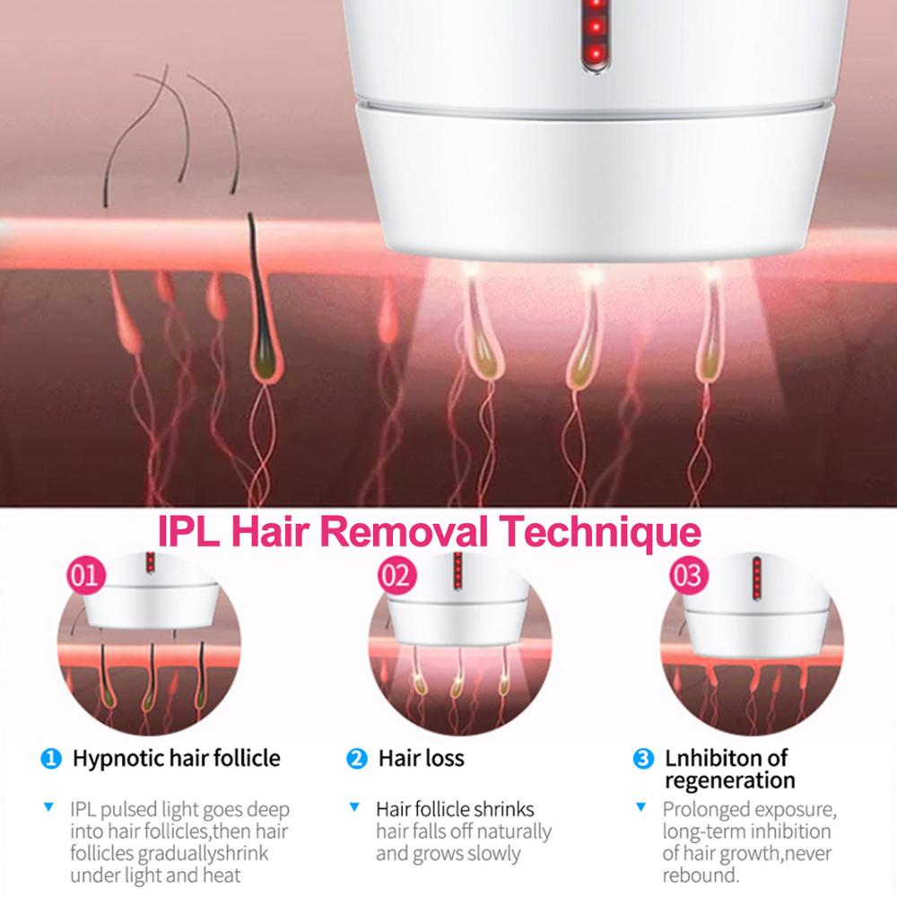 Laser Hair Removal Instrument