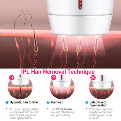 Laser Hair Removal Instrument