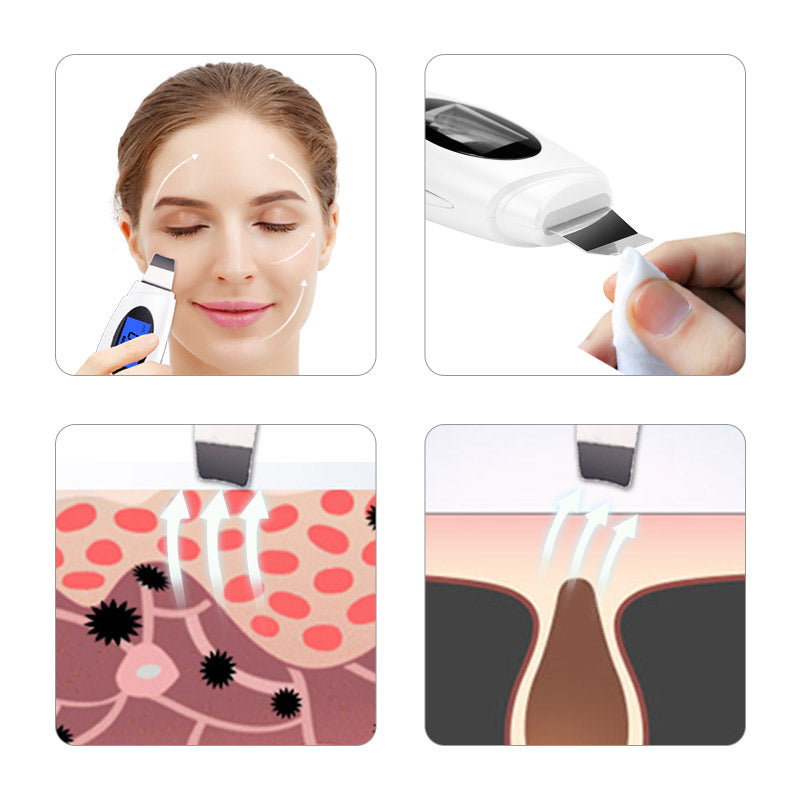 Ultrasonic Multifunctional Blackhead Exfoliator