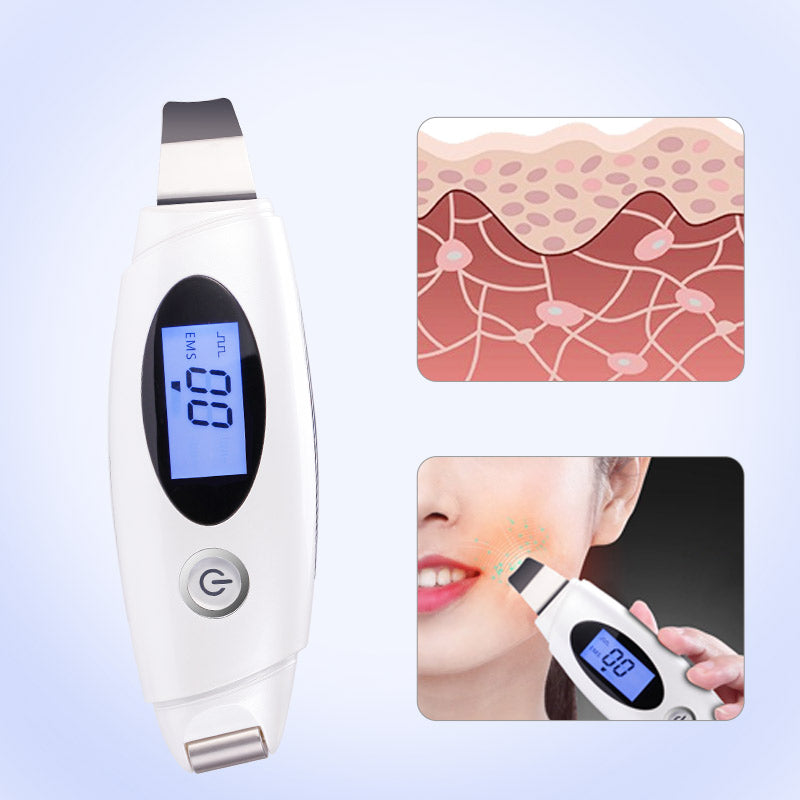 Ultrasonic Multifunctional Blackhead Exfoliator